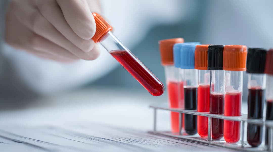 Blood Tests & Hormonal Profile