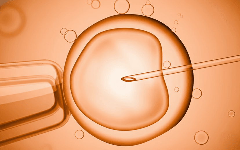 In Vitro Fertilization